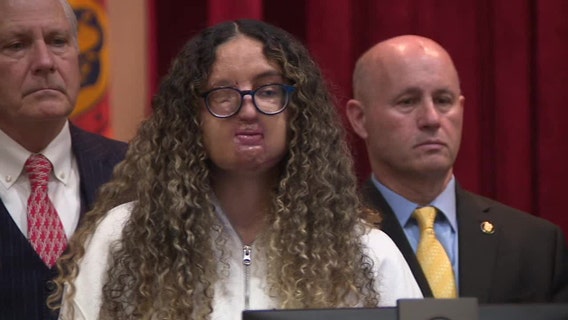 Reward raised in case of Hofstra student attacked with acid