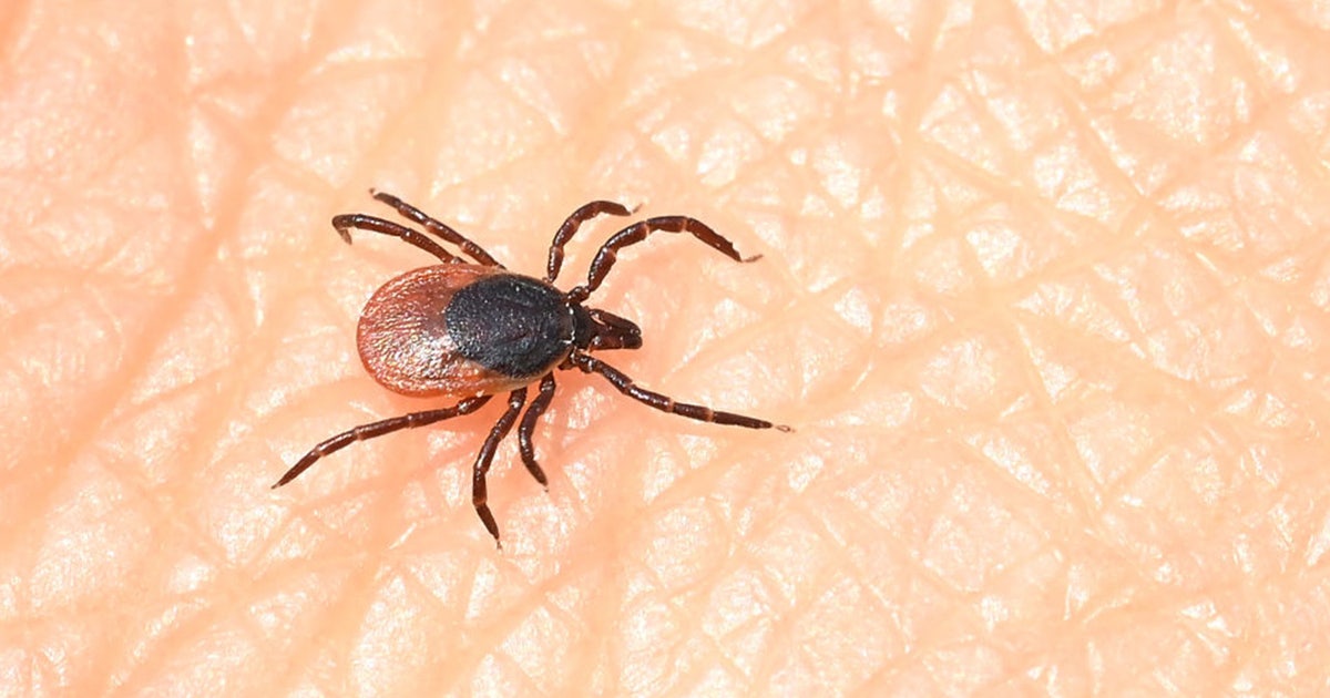 Fox File Tick Tick research at Stony Brook Medicine reveals impact on human health ...