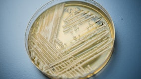 C. auris: Deadly, drug-resistant fungus spreading at alarming rate, CDC says