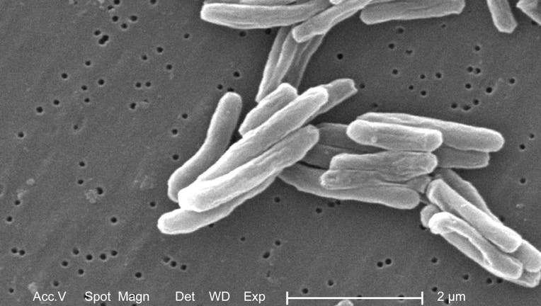 Mycobacterium Tuberculosis