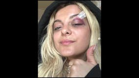 Bebe Rexha drops to knees after being hit by phone during NYC show; suspect facing felony charges