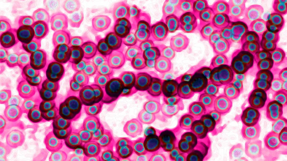 Streptococcus pyogenes