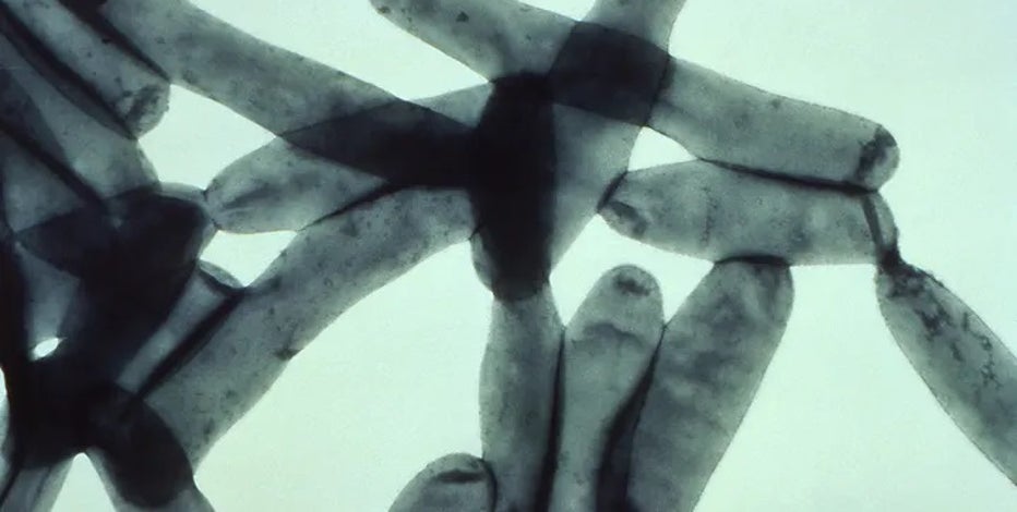 What is Legionnaires' disease? Symptoms, how you get it