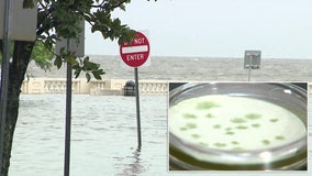Flesh-eating bacteria may be in Hurricane Idalia flood waters