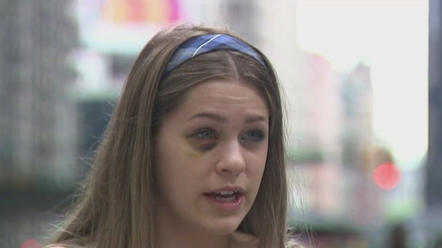 Manhattan student sucker-punched in random assault