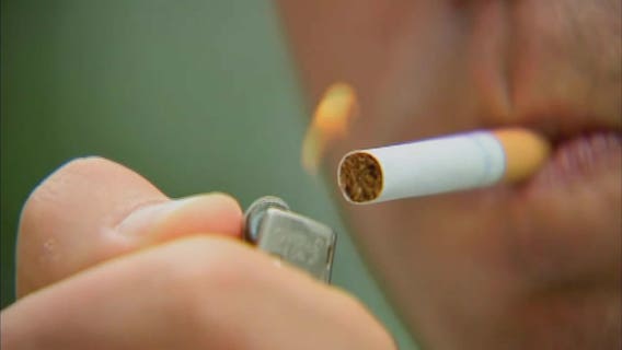 American Cancer Society updates lung cancer screening guidelines