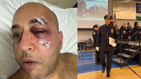 ‘Every New Yorker should be petrified': Uniformed NYPD officer attacked on subway