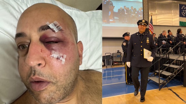 ‘Every New Yorker should be petrified': Uniformed NYPD officer attacked on subway