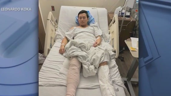 Queens pizza delivery man hospitalized after being struck by e-bike