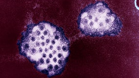 Norovirus 2024: How NJ schools curb stomach bug outbreaks