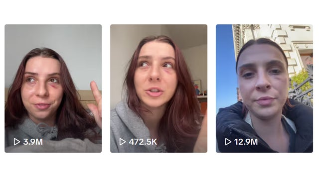 2nd man arrested for randomly punching NYC woman: 'I'm actually in shock'