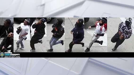 17-year-old punched, kicked, slashed in face by group in the Bronx