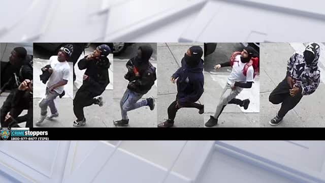 17-year-old punched, kicked, slashed in face by group in the Bronx