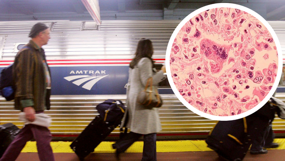 Measles alert: Passenger with virus rode Amtrak train that stopped in NYC