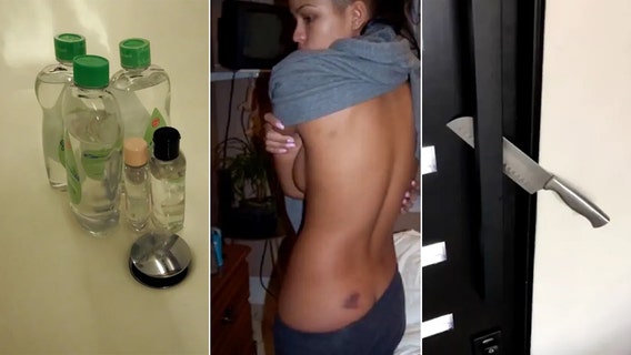 Diddy latest: New photo evidence shows Cassie's injuries, baby oil from raid