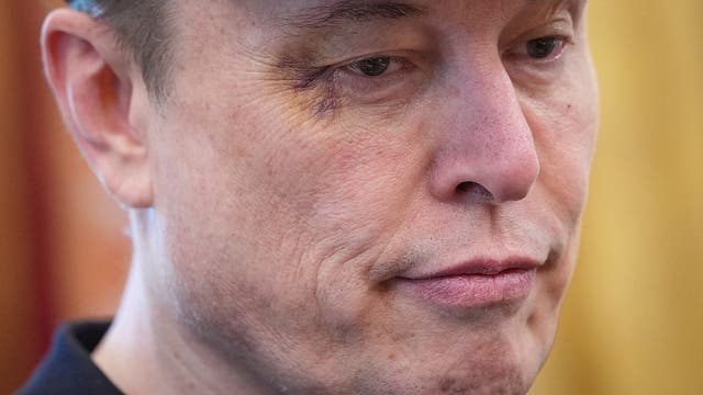 Trump gives Musk White House send-off as mark near eye sparks questions