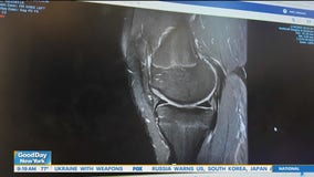 Breakthrough ACL surgery helps patients heal faster