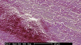 3rd person dies from Legionnaires’ disease outbreak in Harlem