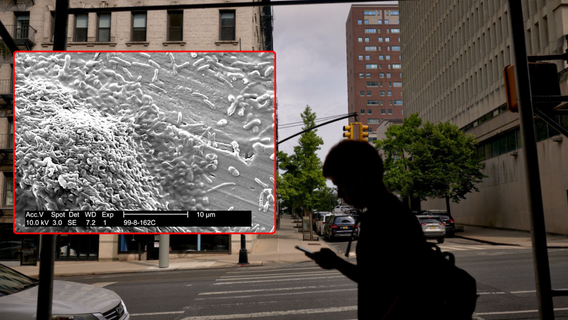 30 Legionnaires’ disease cases confirmed in NYC; 1 death reported