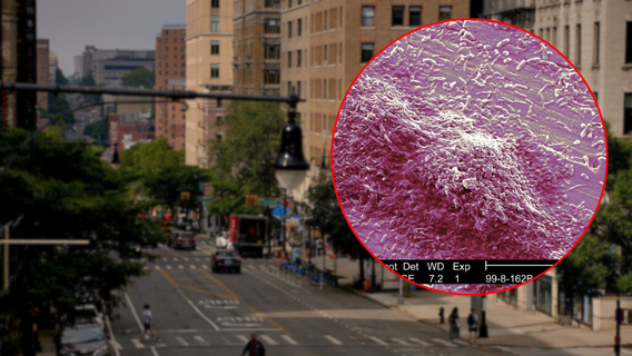 Cluster of Legionnaires' disease cases found in Harlem, health officials say