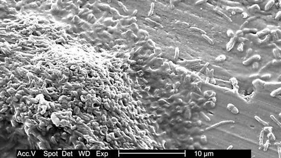 Legionnaire's: 12 cooling towers test positive for live bacteria, 99 cases confirmed