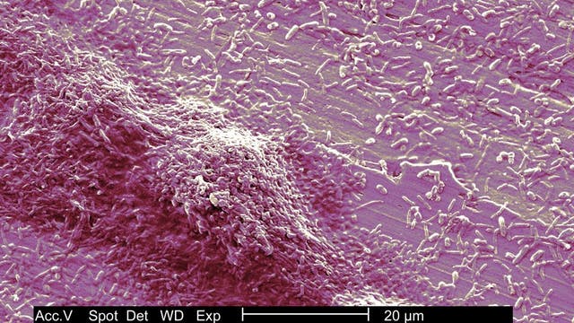 3rd person dies from Legionnaires’ disease outbreak in Harlem