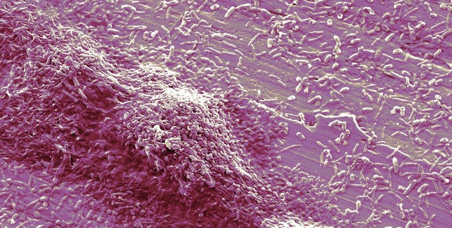 3rd person dies from Legionnaires’ disease outbreak in Harlem