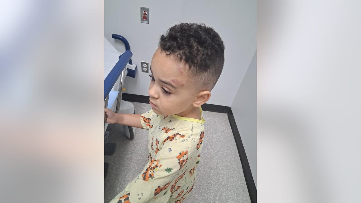 NJ mom demands answers after 3-year-old son with autism returns home bruised