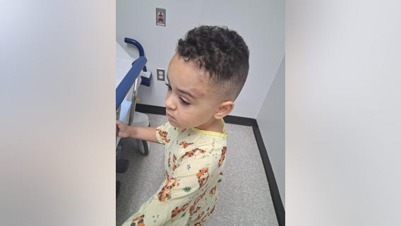 NJ mom demands answers after 3-year-old son with autism returns home bruised