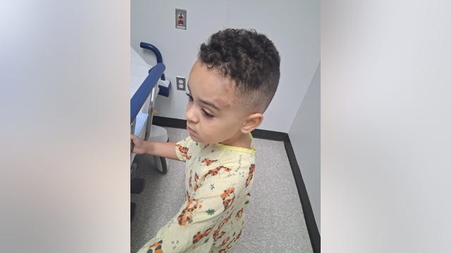 NJ mom demands answers after 3-year-old son with autism returns home bruised