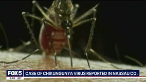 What is the chikungunya virus? First locally acquired case confirmed in New York State