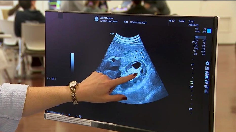 An ultrasound showing a kidney, with a hand pointing at dark spots.