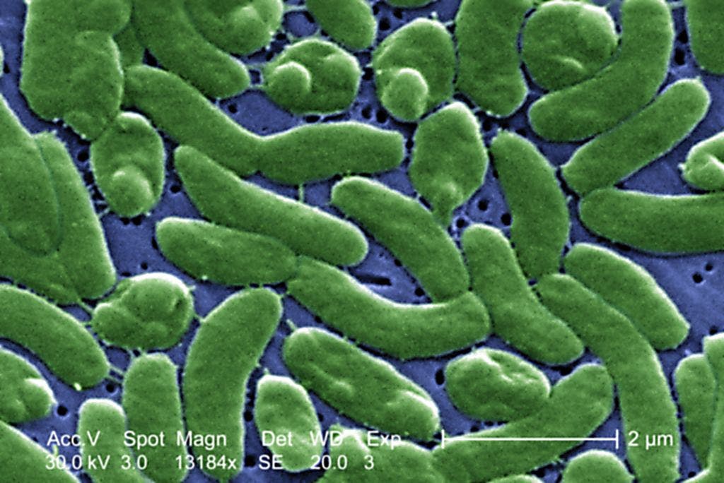 Flesh-eating bacteria that could kill in 2 days found in Long Island waters: report