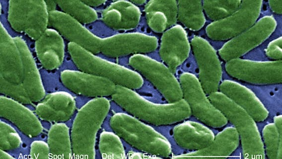 Flesh-eating bacteria that could kill in 2 days found in Long Island waters: report