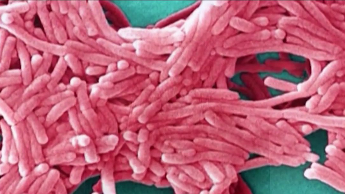 Upper East Side no longer at elevated risk for Legionnaires' disease, NYC health commissioner says