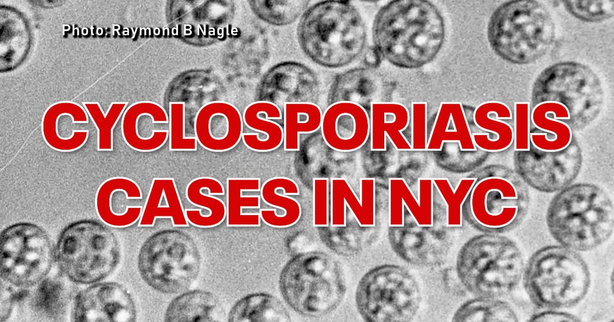 Cyclospora em Nova York supera 440 casos enquanto o departamento de saúde investiga
