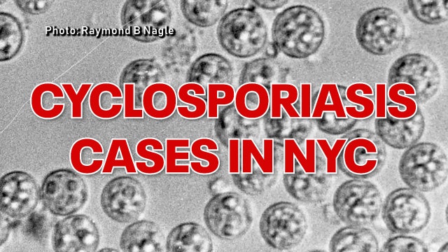 Cyclosporiasis in NYC tops 440 cases as health department investigates
