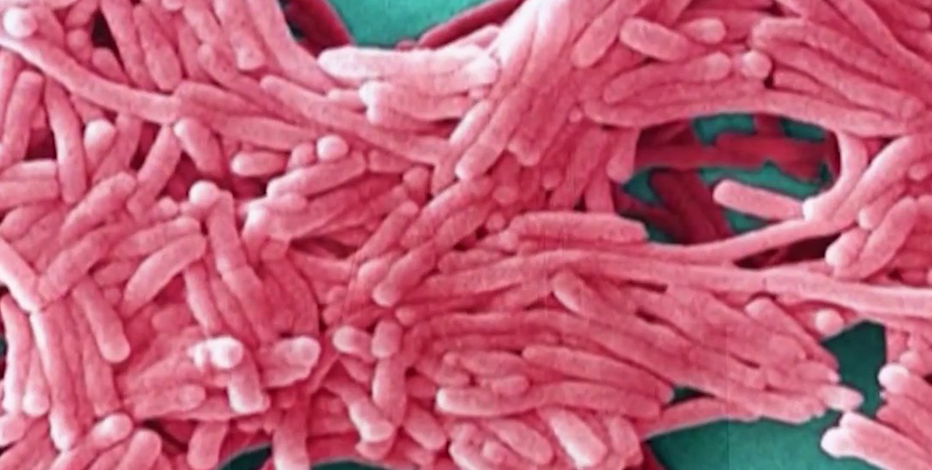 Upper East Side no longer at elevated risk for Legionnaires' disease, NYC health commissioner says