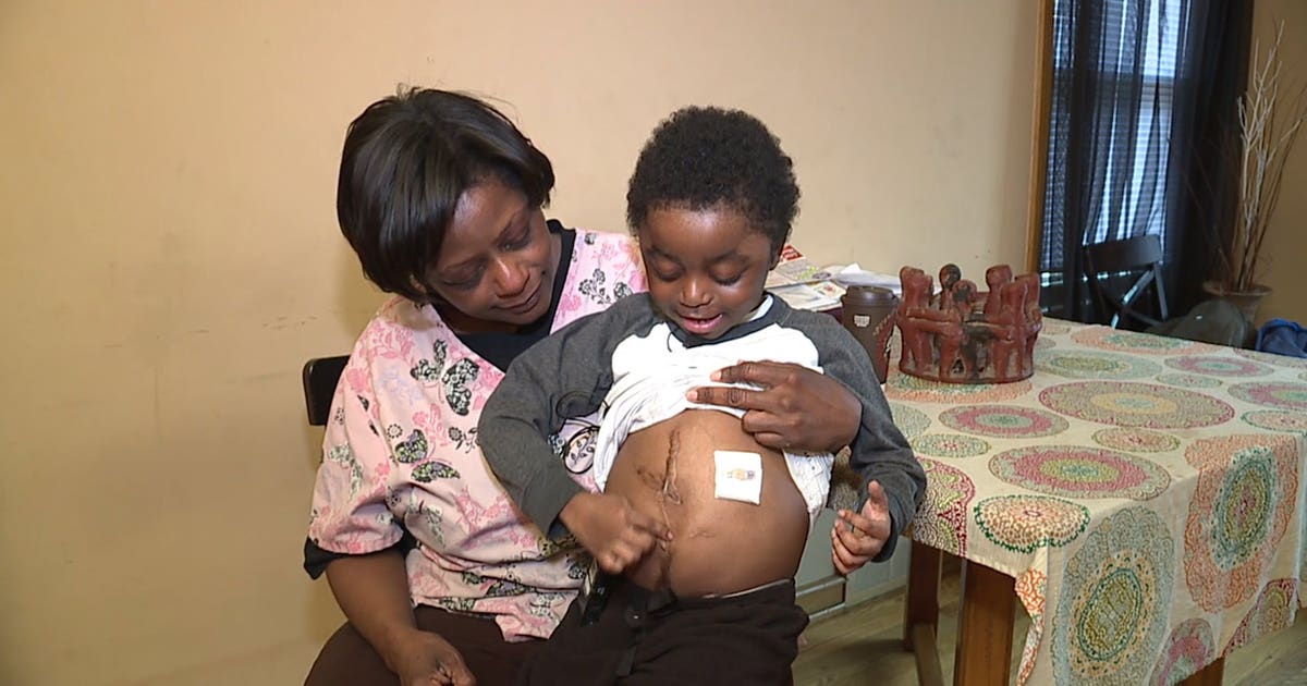 "Something's got to give:" Woman, young son with kidney disease ...