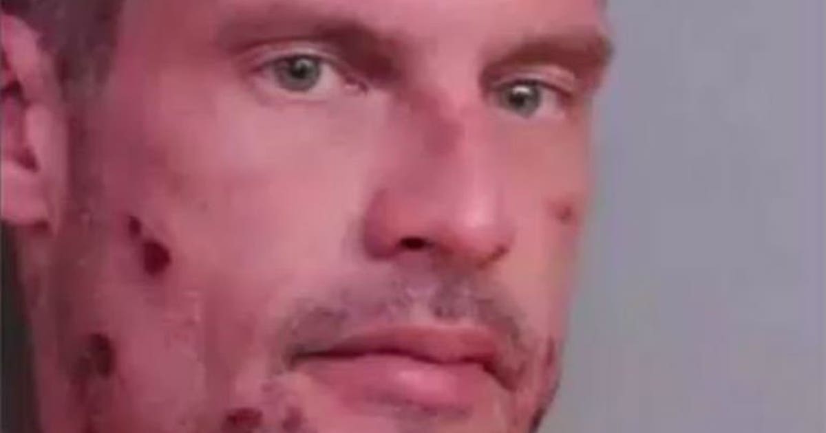 Florida man calls 911 to report himself drunk driving | FOX6 Milwaukee