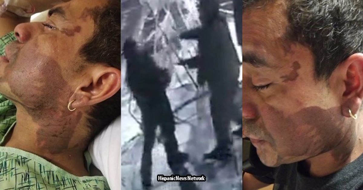 Roommate of man arrested in suspected acid attack says he told him, 'I ...