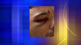 "Grateful to be alive:" Trucker attacked at rest stop had to have part of ear reattached; suspects got $100