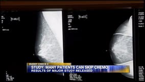 Chemotherapy may not be necessary for the most common form of breast cancer