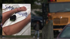 'He did what dogs do:' 2 kids attacked, hurt while walking to bus stop in Racine