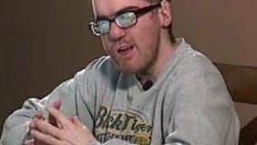 "Doesn't feel good:" Bullies target Ohio man with rare disorder on Facebook