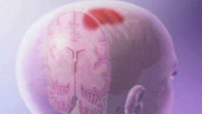 Joint concussion study announced: Obama calls for end to "suck it up" culture in sports