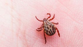 Governor Evers signs bills designed to fight Lyme disease