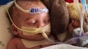 Too graphic? That's what Facebook says of a photo featuring a newborn that needs a new heart