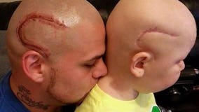 Dad got tattoo to help son feel better about cancer surgery scar: "He felt like a monster"