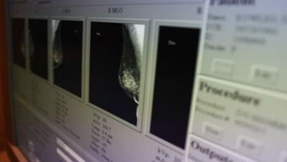 Experimental drug offers new way to battle certain breast cancer